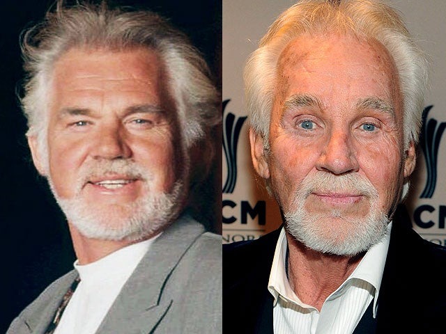 Celebrity Plastic Surgery Disasters?